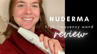 NuDerma High Frequency Wand Review [upl. by Meehyr79]