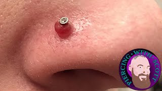 Piercing Bumps  Everything You Need To Know [upl. by Thar]