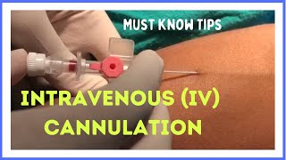 How to Insert IV Cannula  IV Cannulation Technique  Branula  Intravenous Catheter [upl. by Ashti]