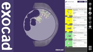 exocad Video Tutorial basic exocam [upl. by Eirameinna]