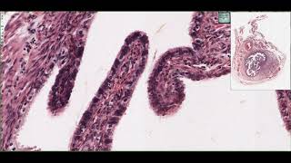 Histology of the Oviduct Fallopian Tubes 4K [upl. by Derrej]