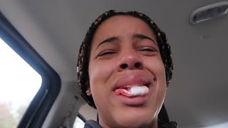 I Got 4 Wisdom Teeth Removed hilarious [upl. by Grantland]